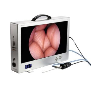 FHD 4 in 1 Image System 24 Inch All-In-One 1080P Diagnostic Endoscope Camera With 80W Led Cold Light Source for Laparoscopy